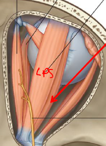 <p>ID/Describe this muscle</p>