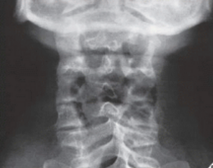 <p>what view + position of pt</p>