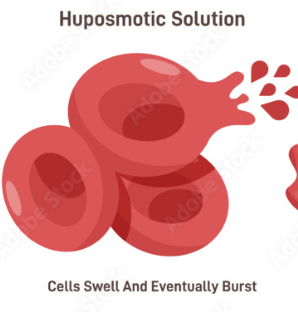 <p><span style="font-family: Calibri, sans-serif; line-height: 115%;"><strong><span>Hypotonic</span></strong></span></p>