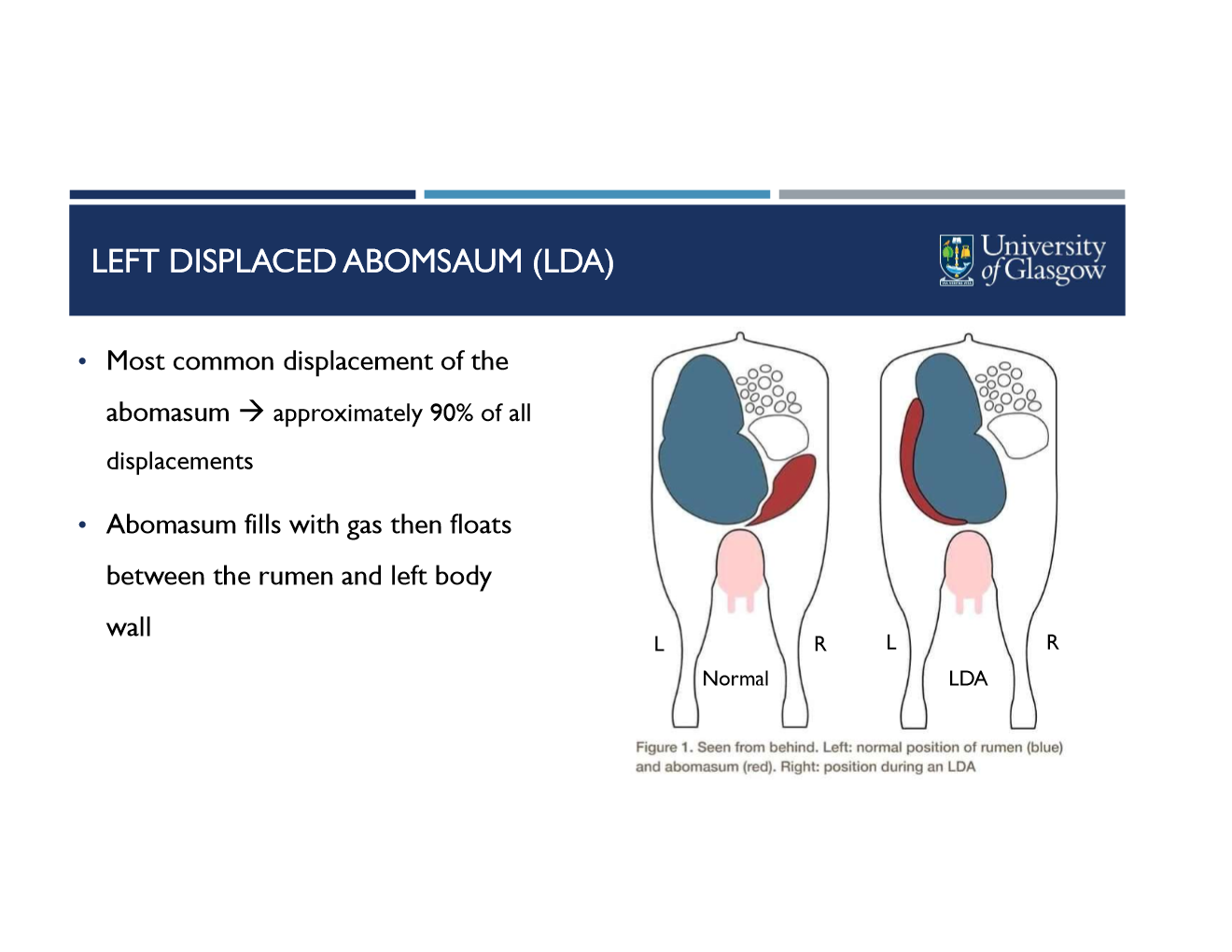 <ul><li><p>most common displacement (90% of all)</p></li><li><p>abomasum fills with gas then floats btwn rumen and left body wall</p></li></ul><p></p>
