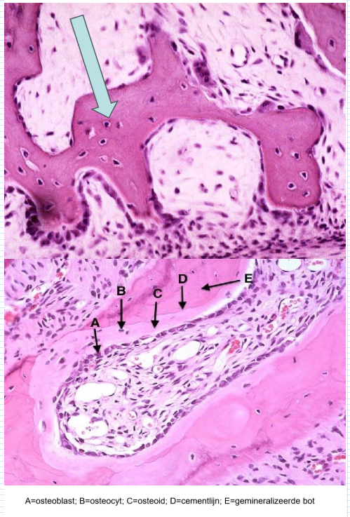 <p><em>de botcellen: osteocyt</em></p>