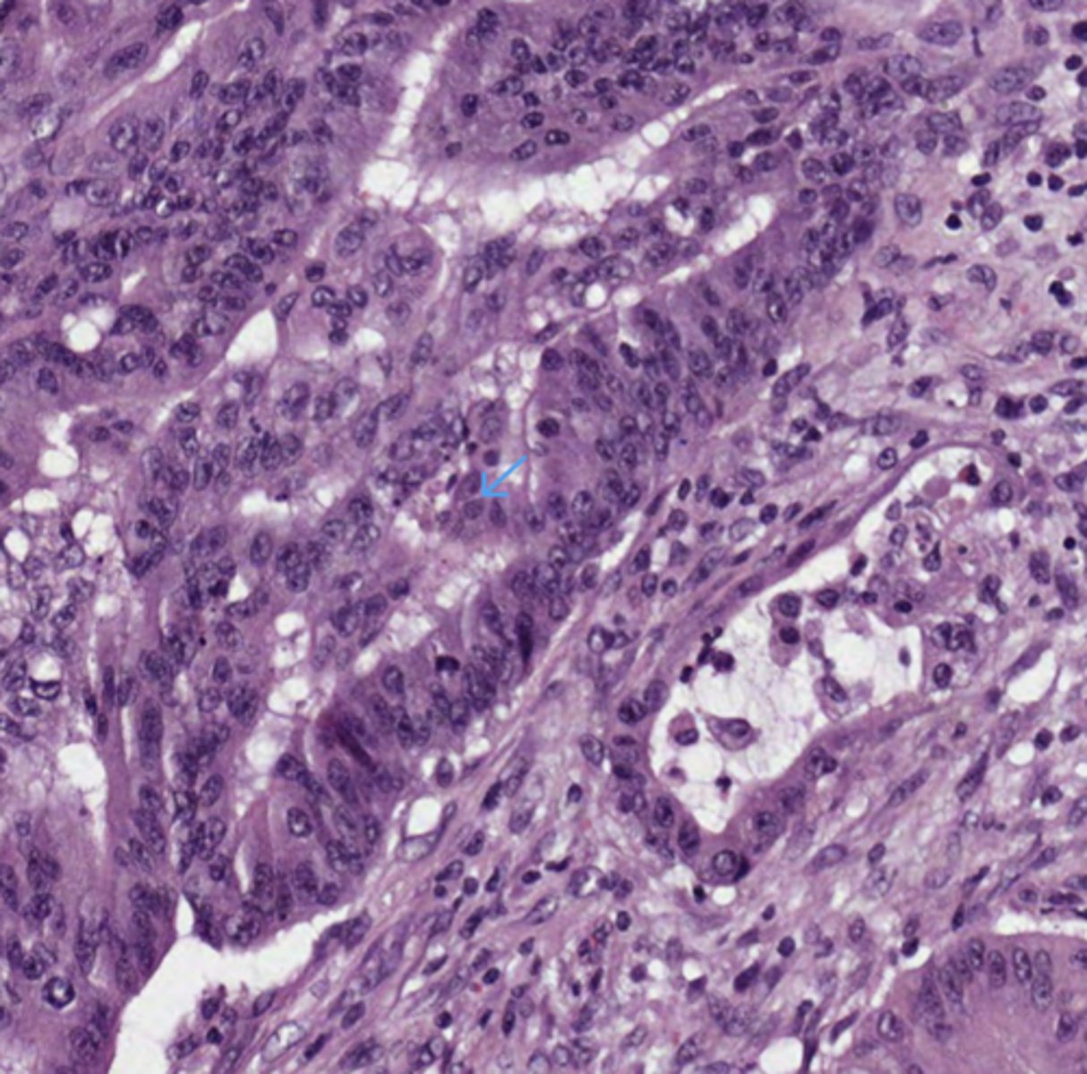 <p>Colon</p>