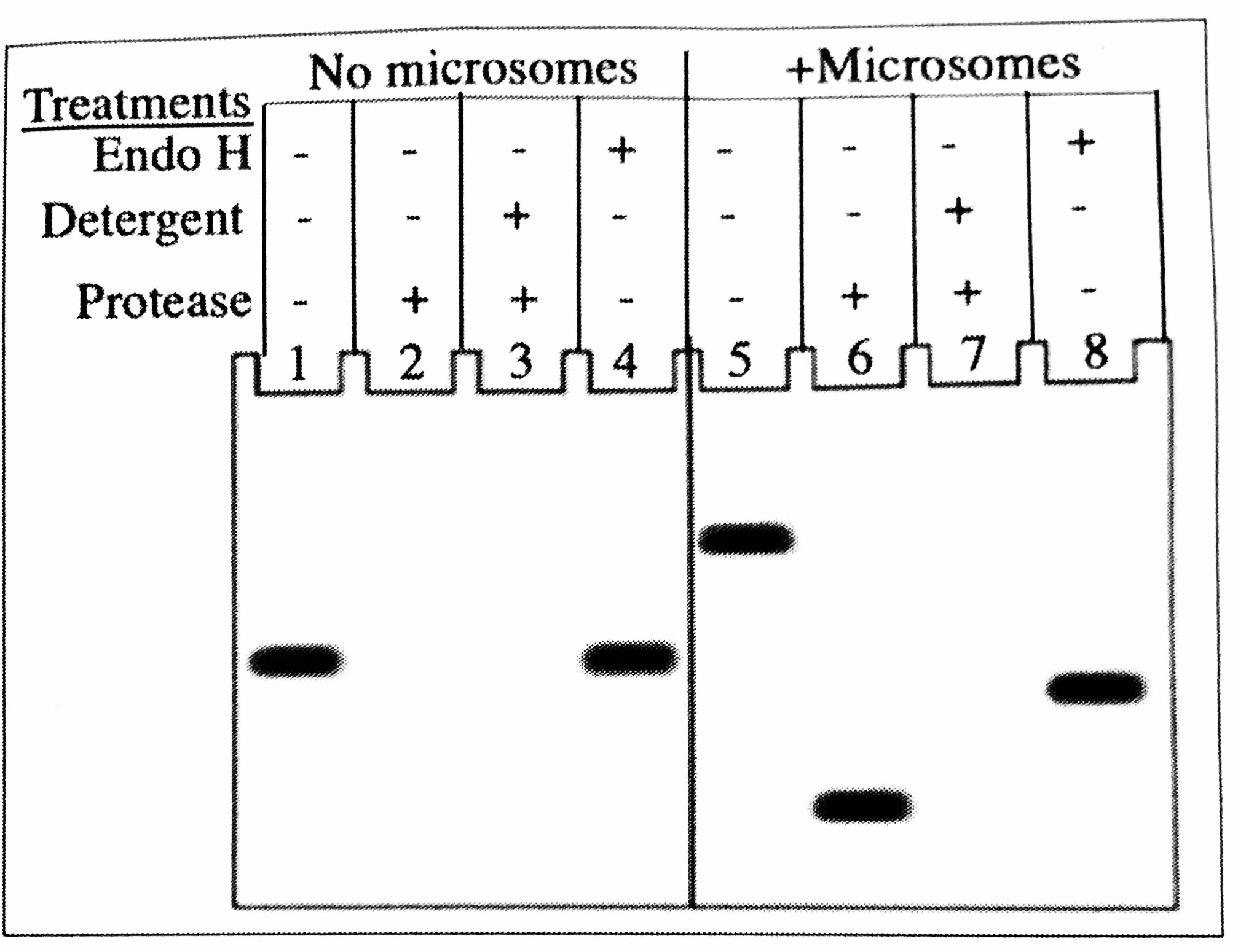 <p>The figure shows the results of mRNA translation in the presence and absence of microsomes with various treatments. The addition of endoglycosidase (Endo H) removes N-linked sugars, Based on the results presented in the figure, you conclude that this protein in the cell would be localized to:</p>