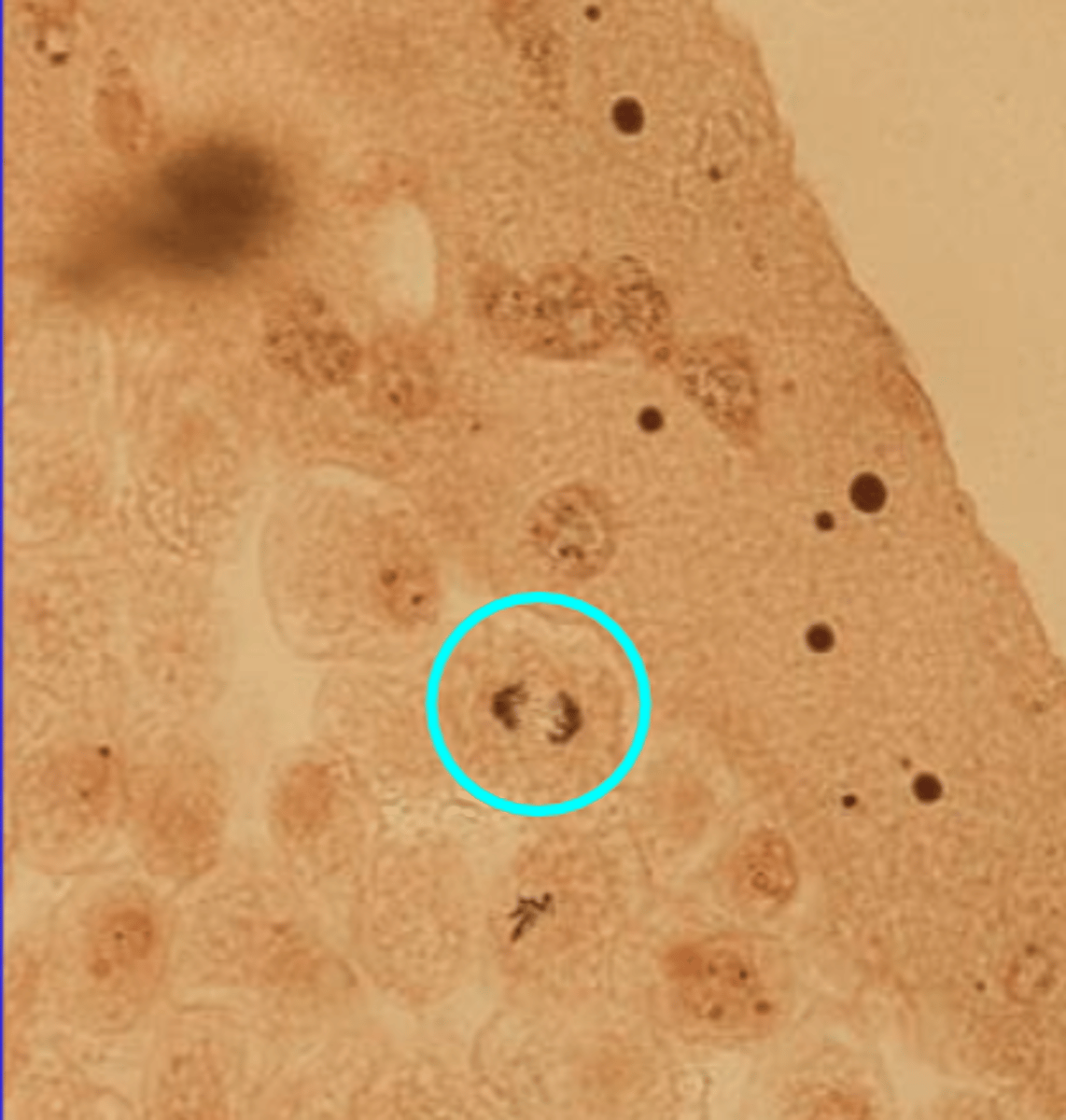 <p>chromosomes separate and move to opposite ends of the cell</p>