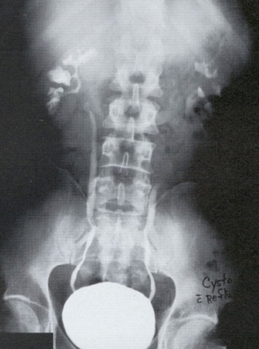 <p>What is this pathology?</p>