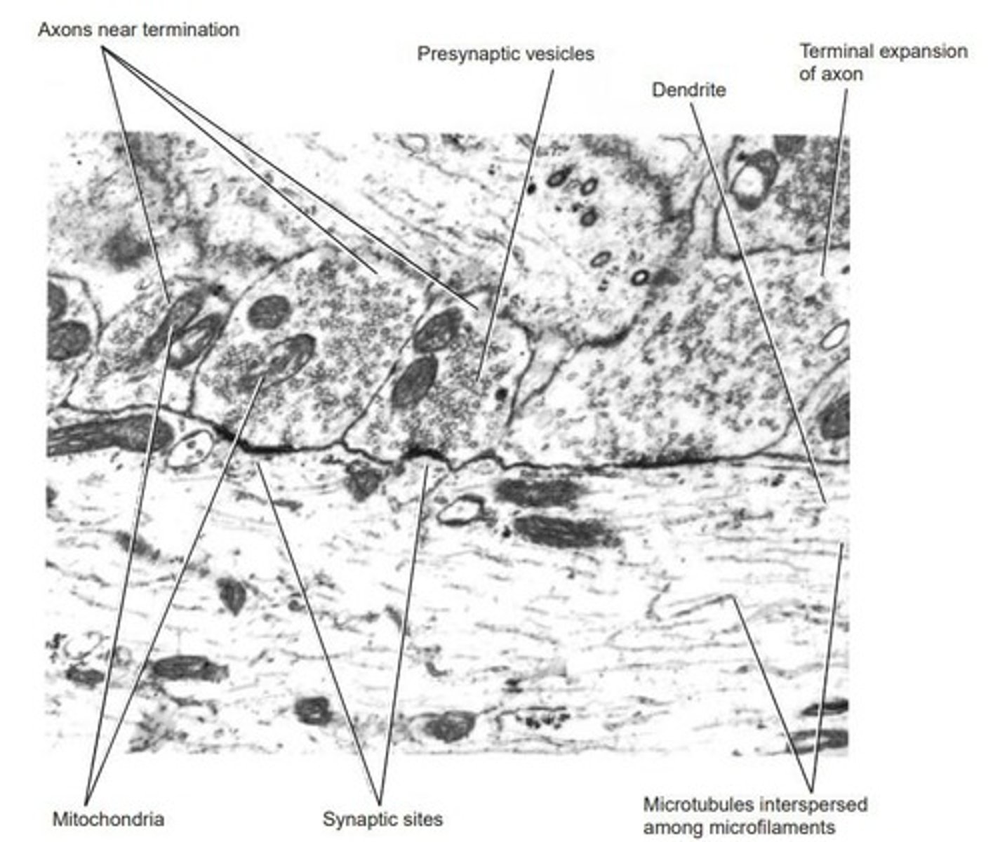 <p>Contain neurotransmitters released into synaptic cleft.</p>