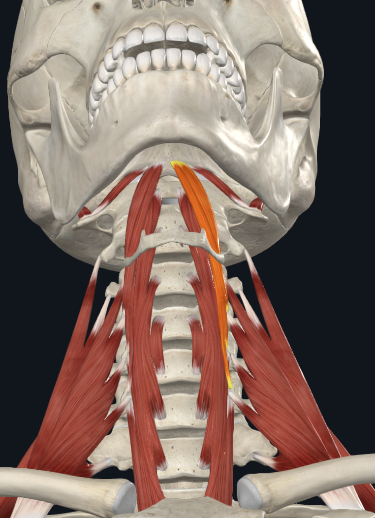 <p>What muscle is this?</p>