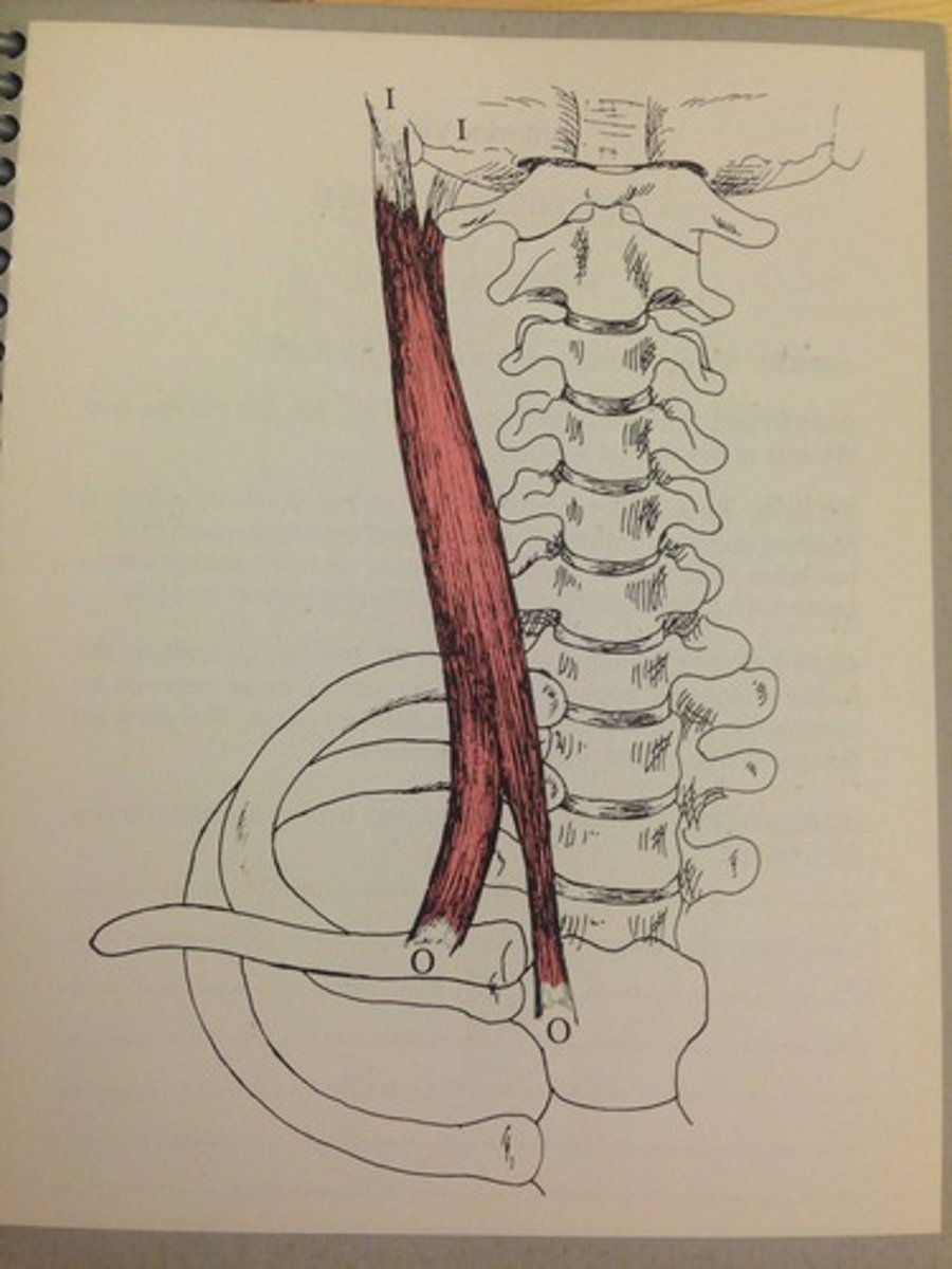 <p>Named according to origin and insertion (origin named first) (e.g., sternocleidomastoid attaches to sternum and clavicle, inserts on mastoid process)</p>