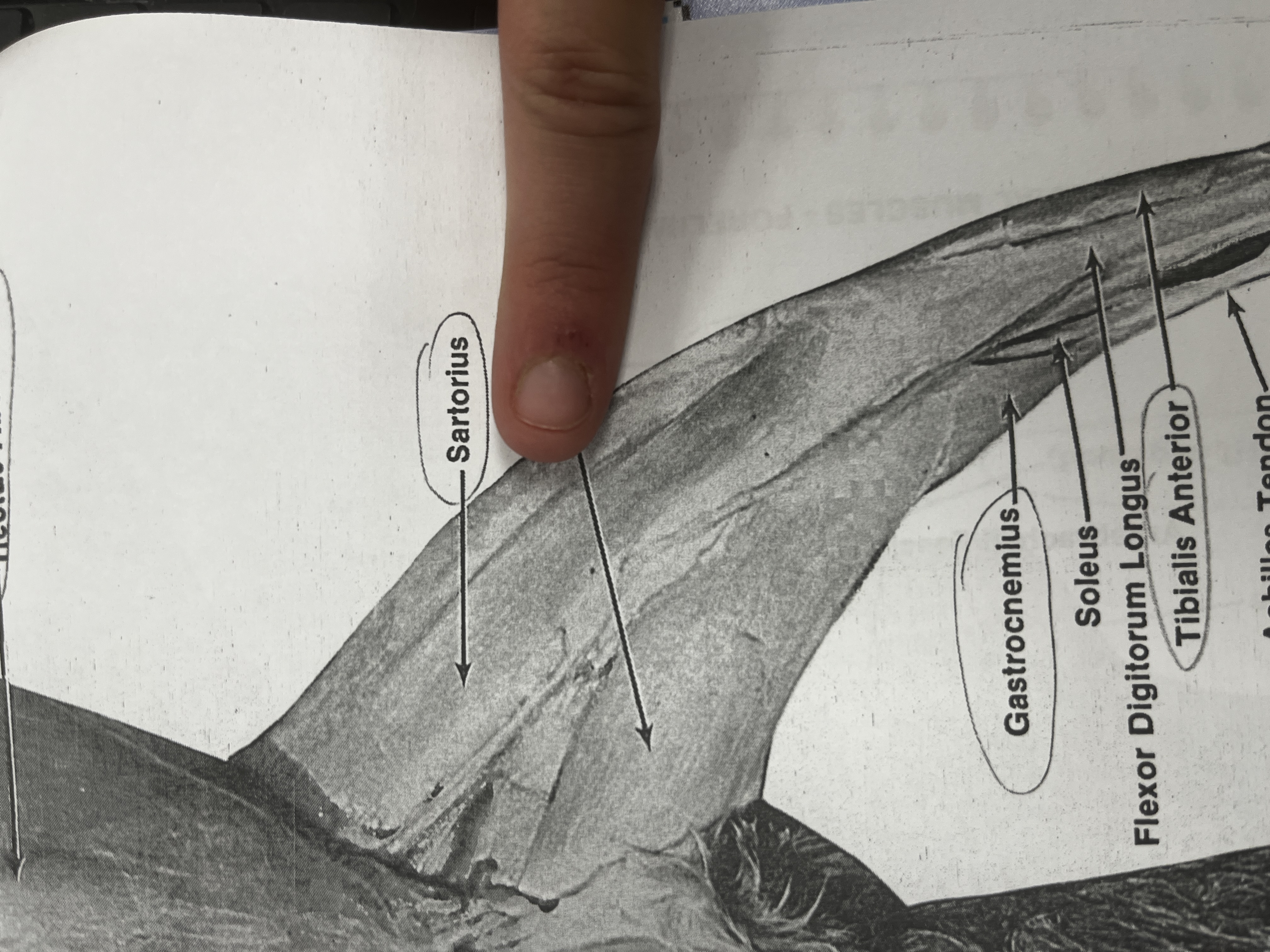 <p>A long, thin muscle in the inner thigh that aids in hip and knee movement.</p>