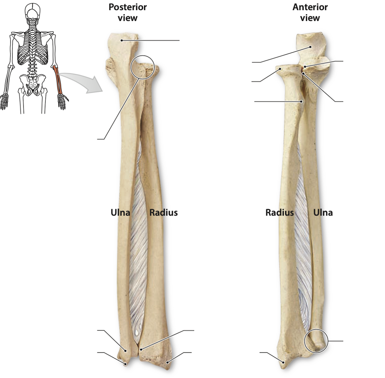 <p>Identify the bone features of the radius + ulna&nbsp;</p>
