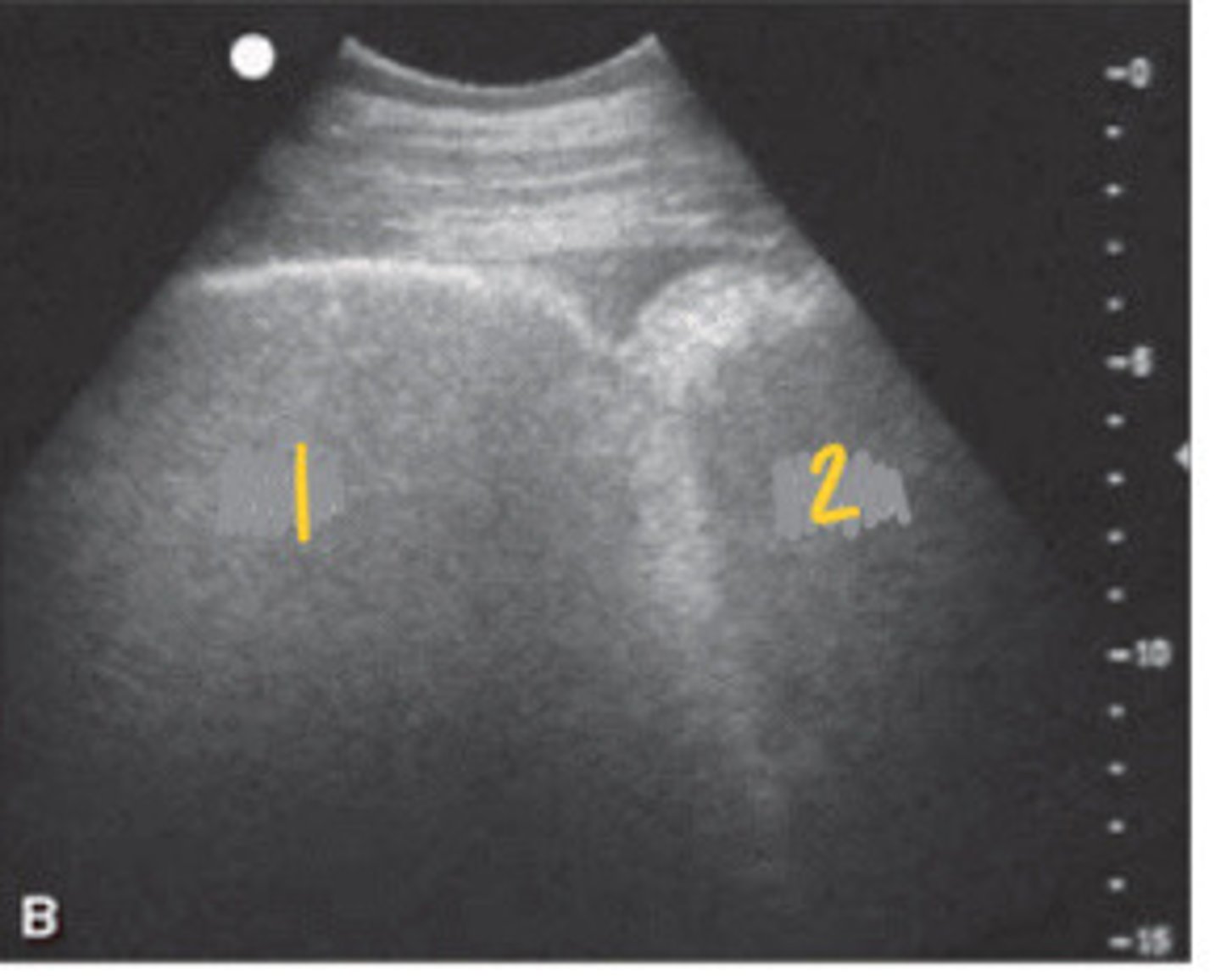 <p>What FLASH view is this in horses and what are the numbers showing you?</p>
