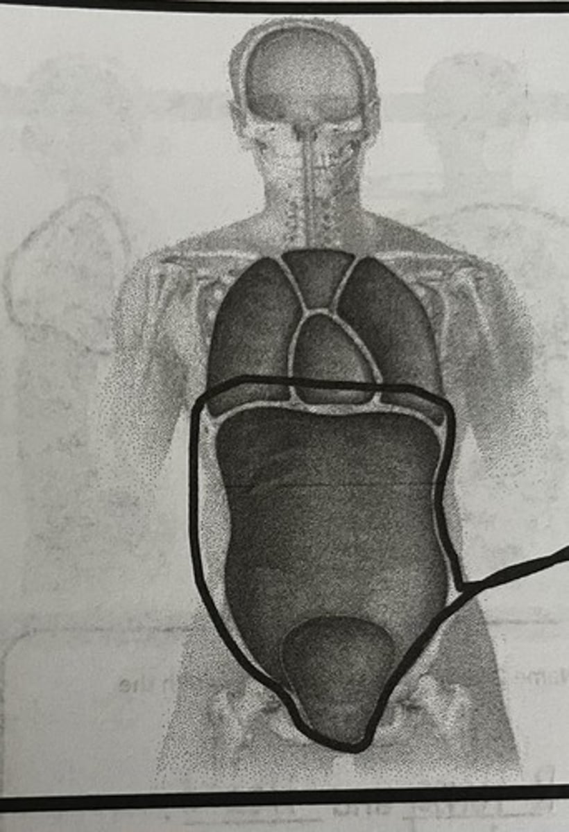 <p>What cavity does this picture represent?</p>