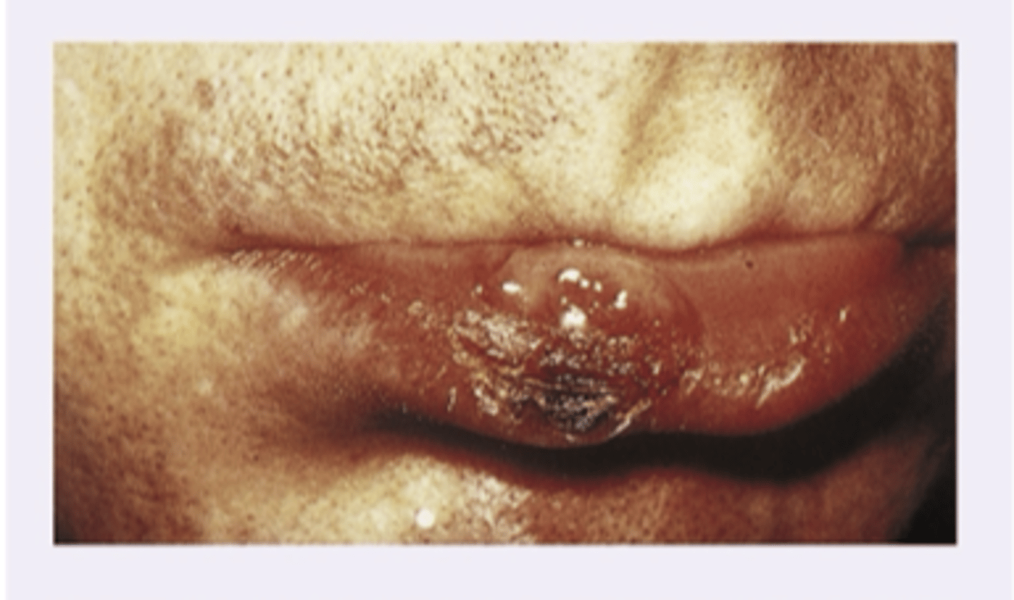 <p>Diagnosis?</p>