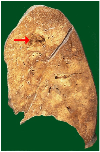 <ol><li><p>Identify the type of cell death and CD</p></li></ol><p></p>