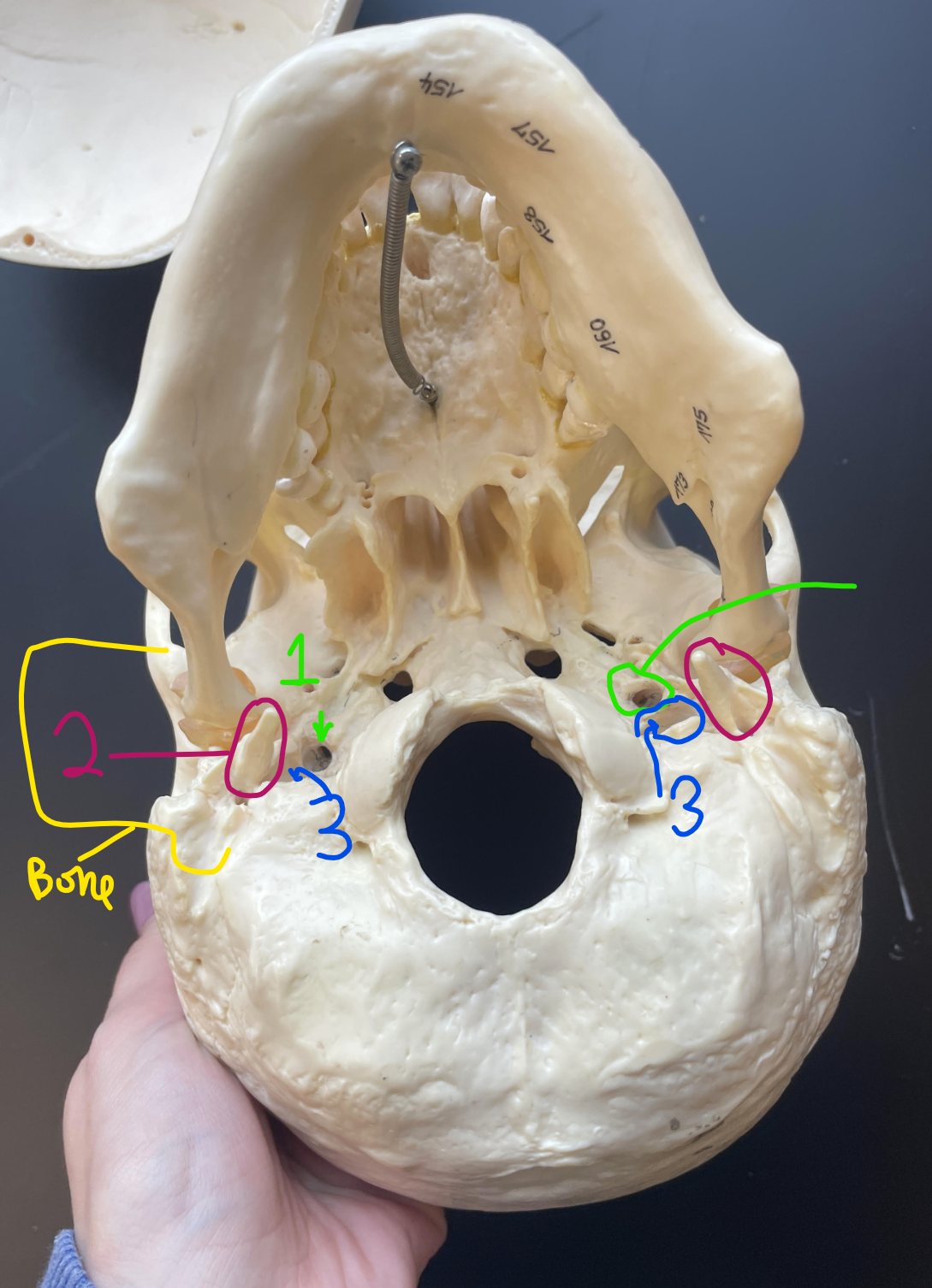 <p>what bone landmark is #2?</p>