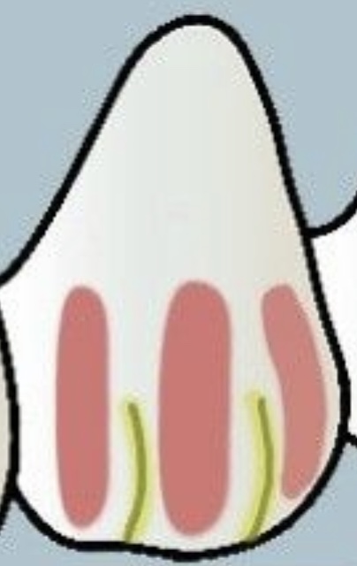 <p>1 vd primaire anatomische onderverdelingen vd tandkroon, gescheiden dr ontwikkelingsgroef</p>