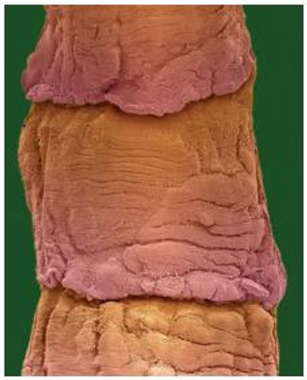 <p>each segment in the strobila of a tapeworm, containing a complete sexually mature reproductive system</p>