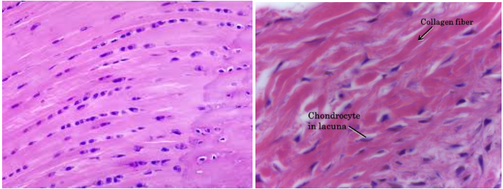 <ul><li><p>Characteristic: <strong>SLIGHTLY LESS FIRM MATRIX </strong>which means we could <strong>SEE THE COLLAGEN FIBERS</strong>; still has the chondrocytes and lacunae</p></li><li><p>Location: <strong>VERTEBRAL DISKS </strong></p></li><li><p>Function: GIVE <strong>MORE SUPPORT AND PADDING </strong></p></li></ul><p></p>