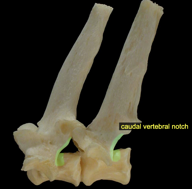 <p><span>The caudal vertebral notch of one vertebra aligns with the cranial vertebral notch of the next (caudal) vertebra, together creating an </span>intervertebral foramen<span> through which a spinal nerve will pass.</span></p>