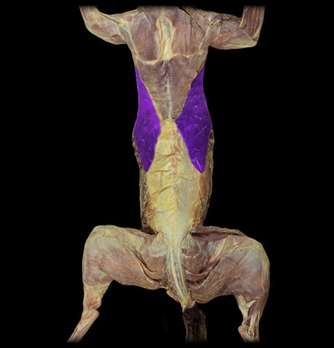 <p>name this muscle</p>