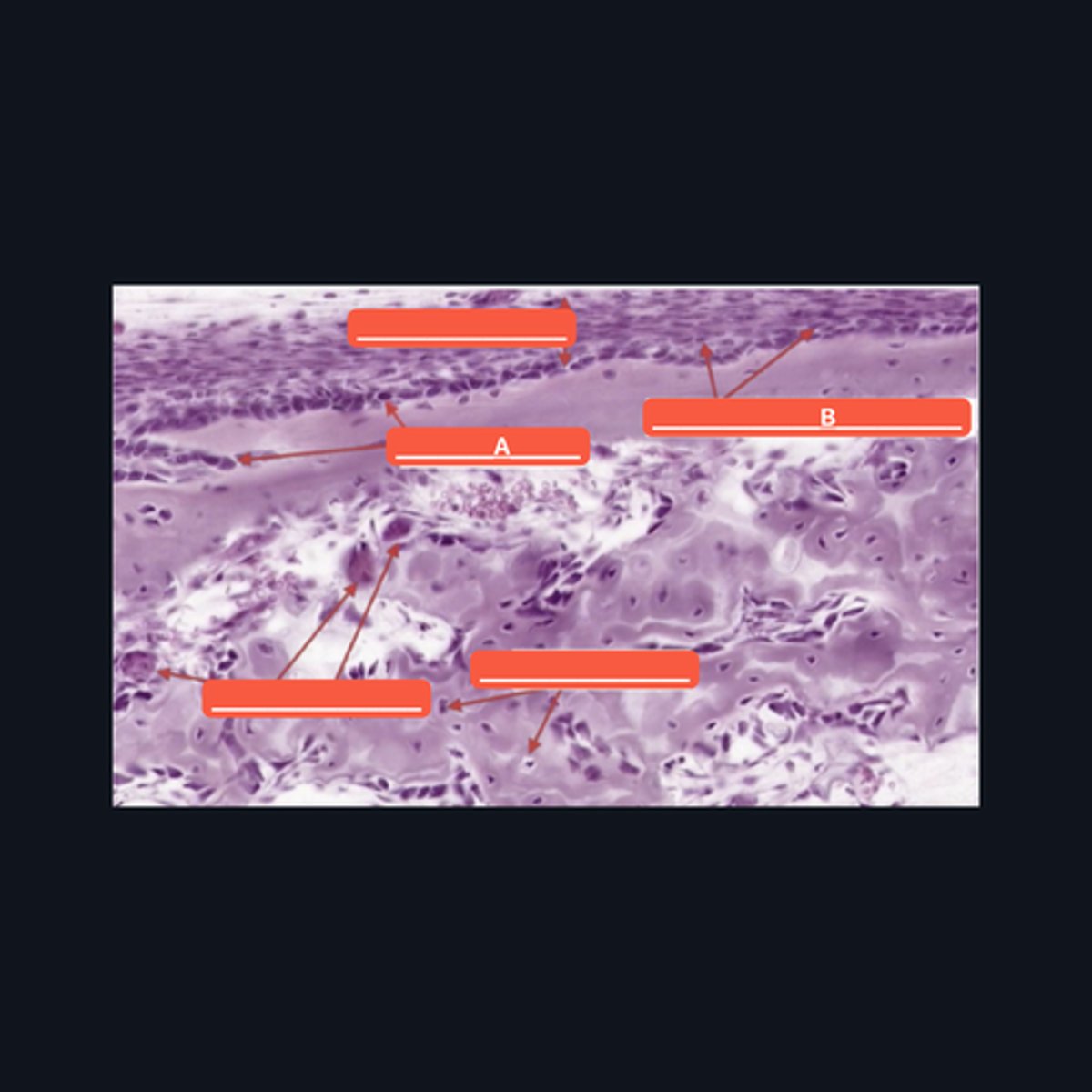 <p>Identify structure A</p>
