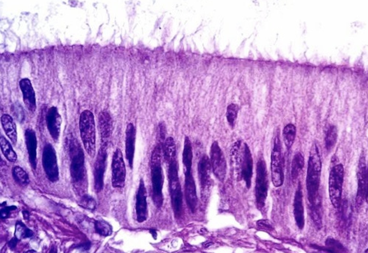 <p>¿Cual es la especialización apical de la imagen?</p>