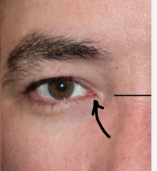 <p>What does the arrow refer to</p>