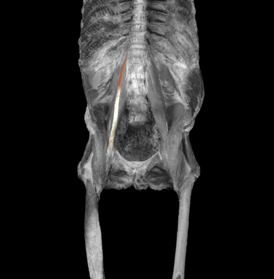 <p>origin: lateral body of T12, L1</p><p></p><p>insertion: pectineal line of pubis </p><p></p><p>action: flex vertebral column</p><p></p><p>innervation: spinal nerve L1 </p>
