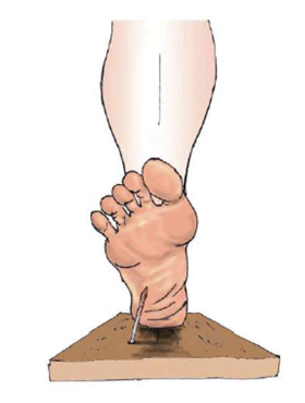 <p>if you step on a rusted nail, would you want to know about it? why?</p>