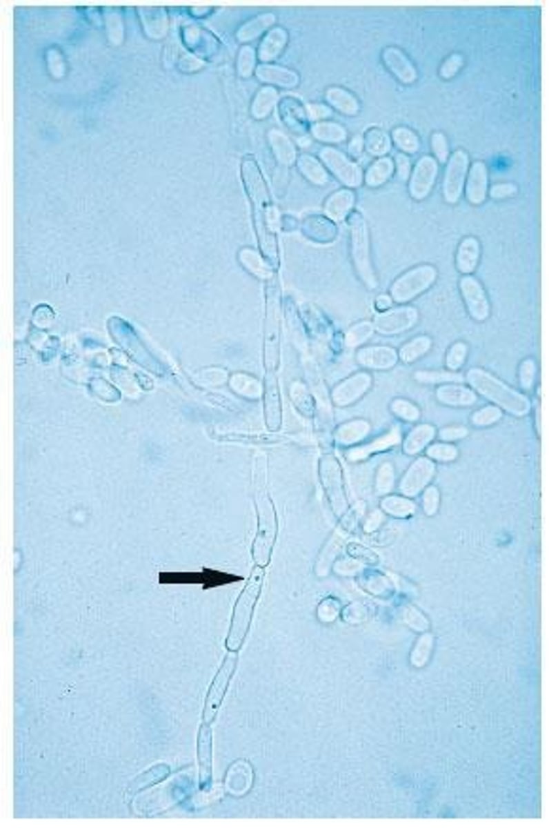 <p>Major pathogen causing various infections, part of normal flora.</p>