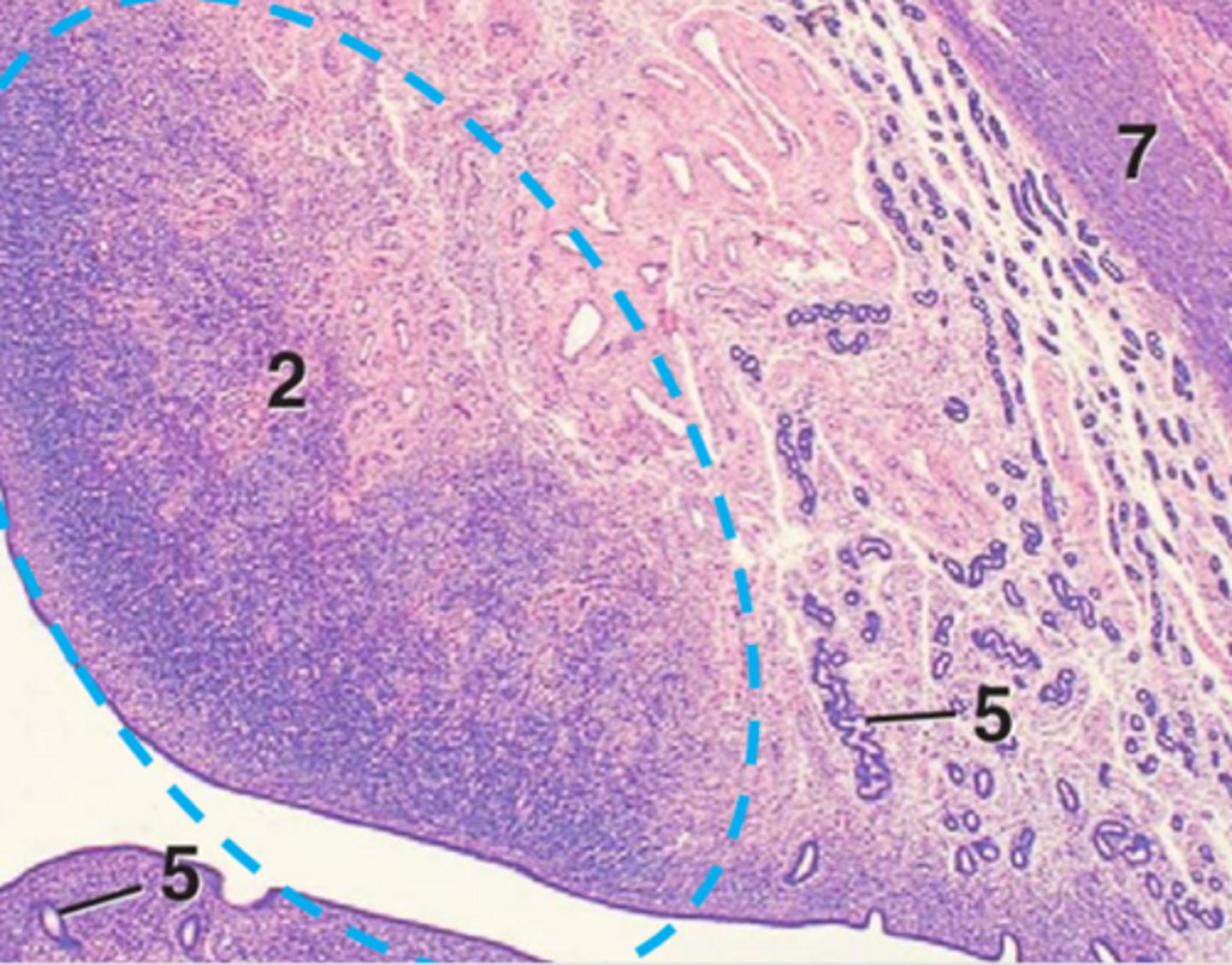 <p>what do caruncles lack?</p>
