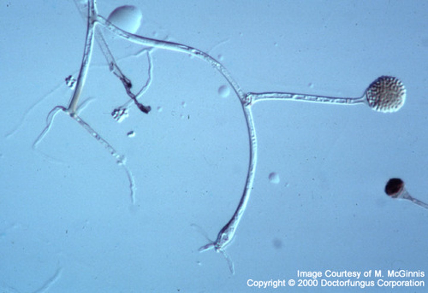 <p>immature, irregularly placed rhizoids</p>