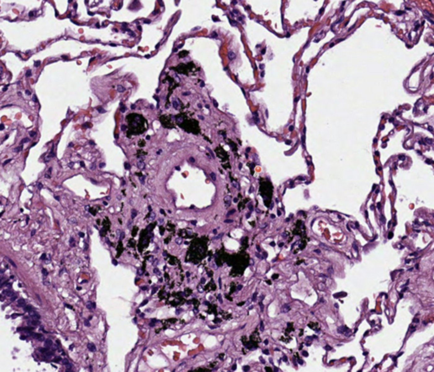 <p>Lung</p>