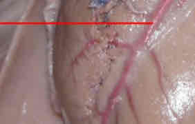 <p>Identify this structure</p>