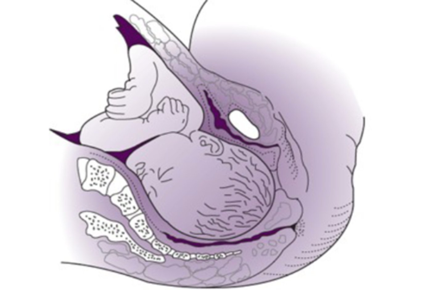 <p>-present part passing through the pelvis</p><p>-continues till the fetus is delivered</p>
