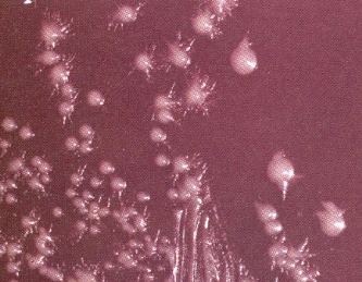 <p>What species of yeast can have <strong>tiny projections</strong> from its colonies?</p>