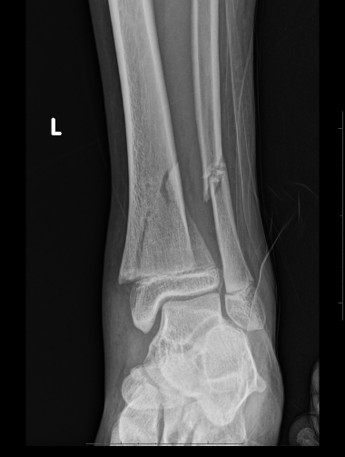 <p>M</p>