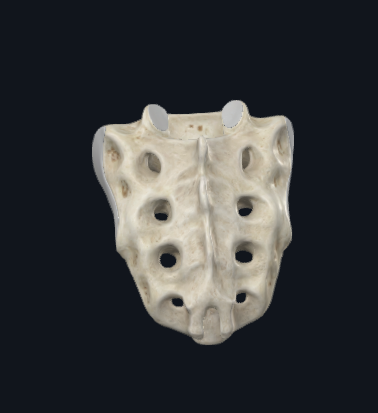 <p>What bone is this?</p>