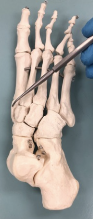 <p><span style="font-family: -apple-system, system-ui, Segoe UI, Roboto, Helvetica Neue, Arial, Noto Sans, Liberation Sans, sans-serif, Apple Color Emoji, Segoe UI Emoji, Segoe UI Symbol, Noto Color Emoji">Identify this bone.&nbsp;</span></p>
