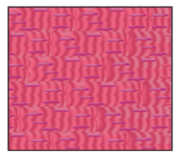 <p>What type of muscle is ths\is?</p>