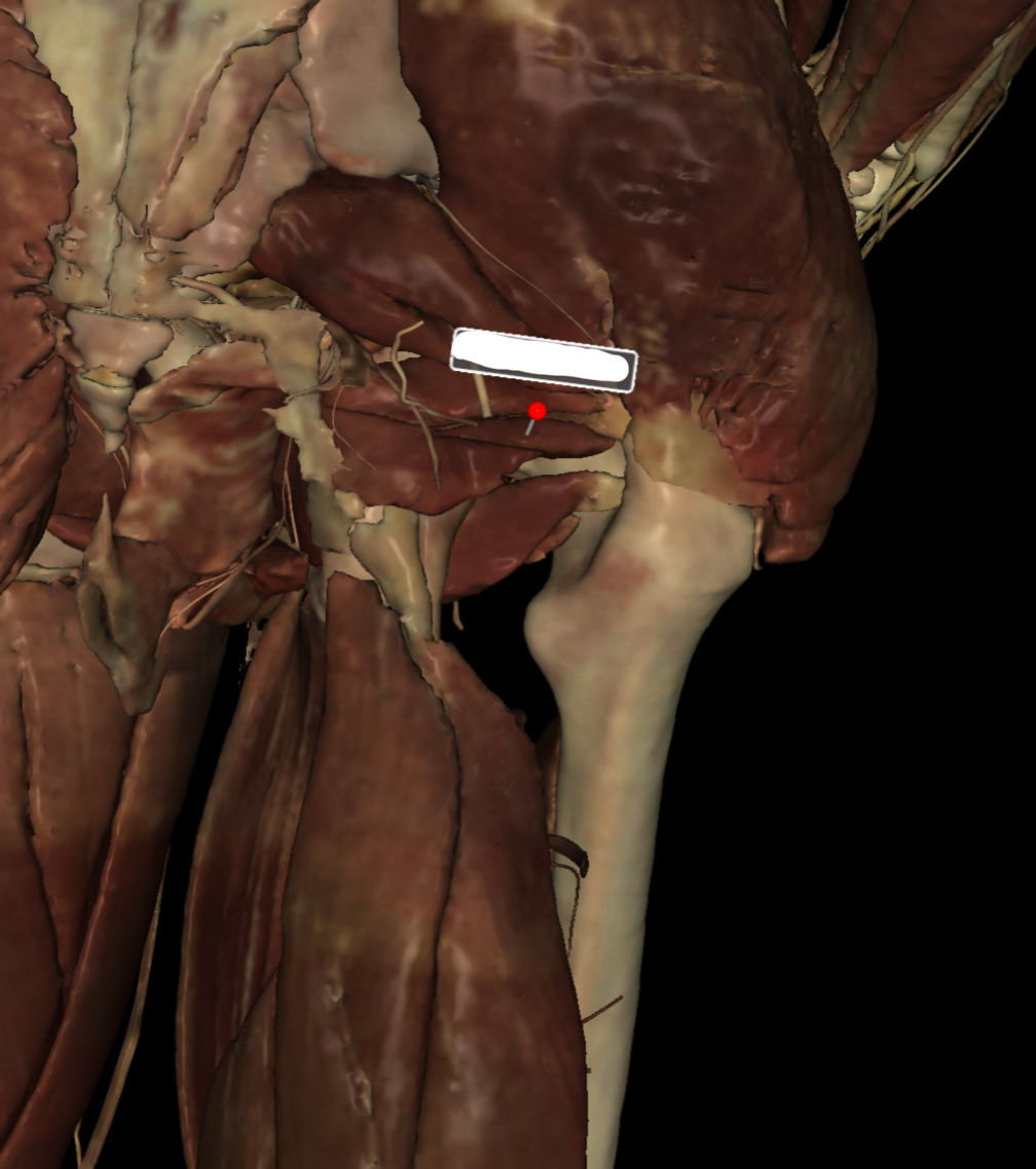 <p>Identify the Structure</p>