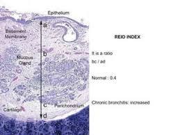 <p>Which disease does this represent? </p>