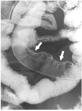 <p>What is this and what type of scan </p>