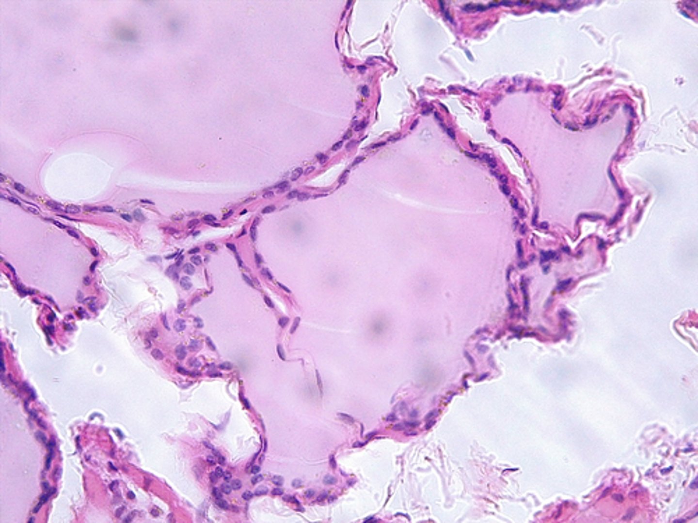 <p>air sacs of the lungs and the lining of the heart, blood vessels, and lymphatic vessels</p>