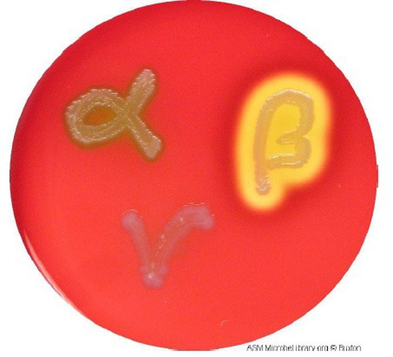 <p>Beta hemolytic</p>