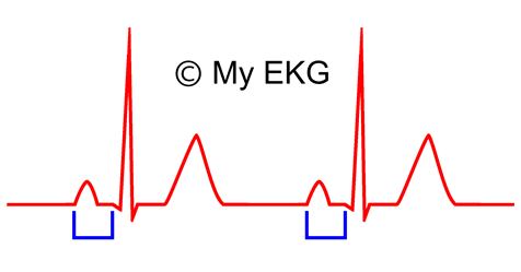 <p>What segment is this (the blue bracket)</p>
