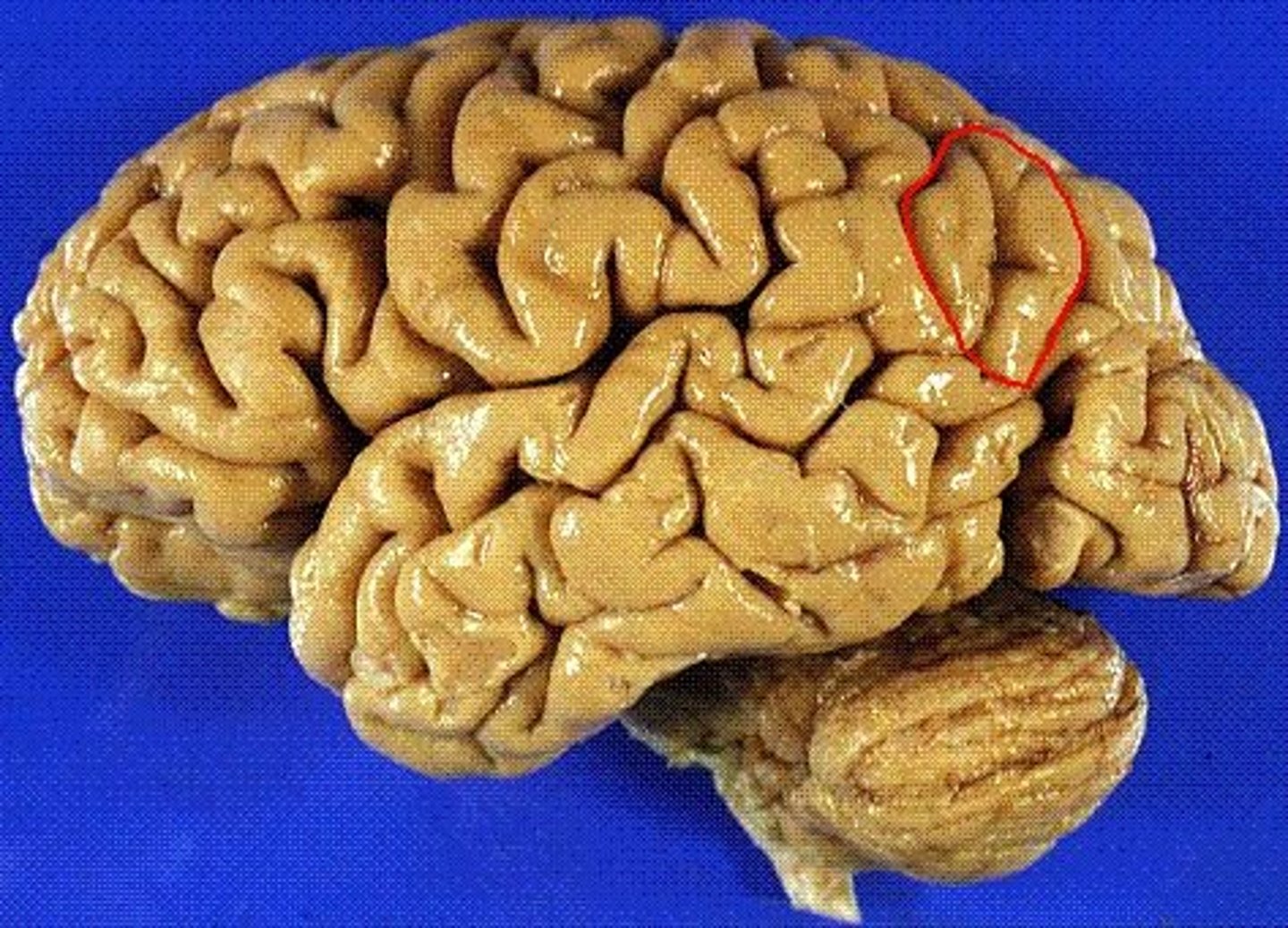 <p>part of inferior parietal lobe</p>