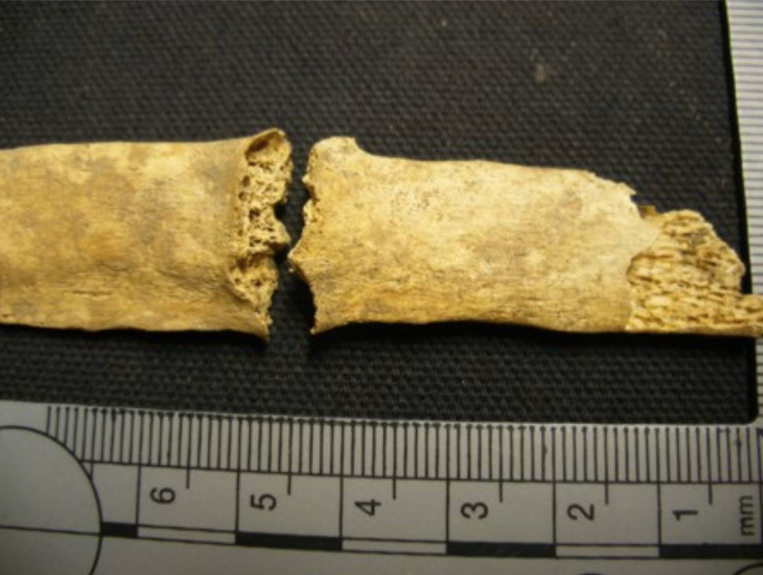 <p><span>What type of fracture is this and did it occur antemortem or perimortem?</span></p>