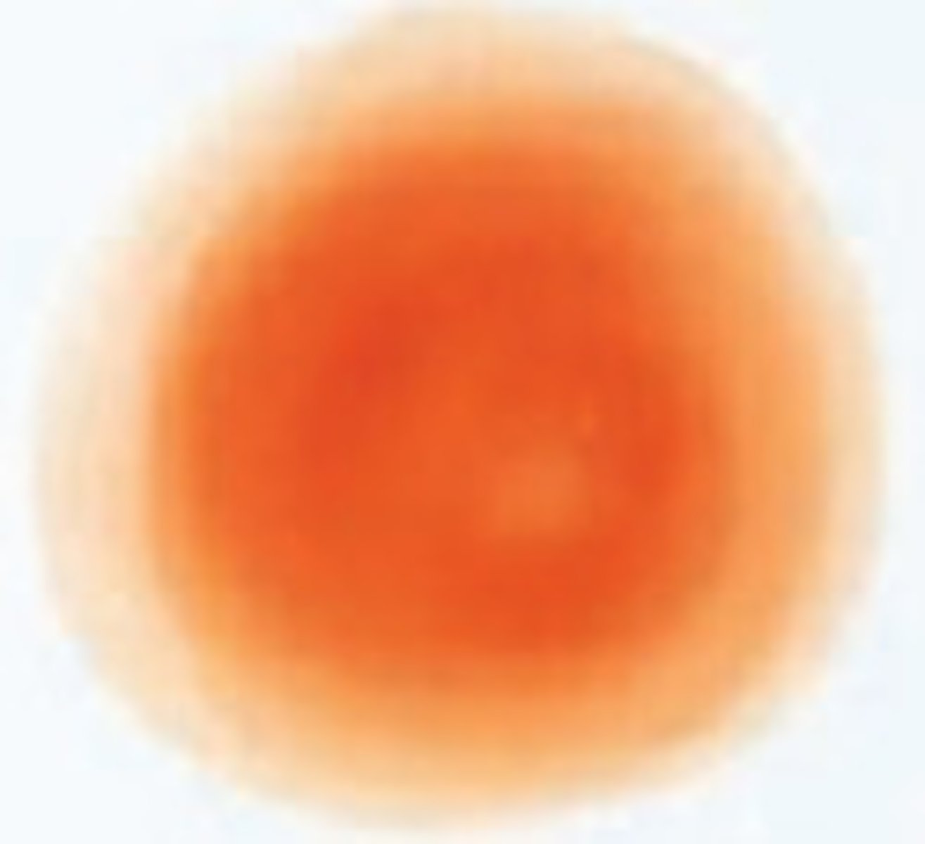 <p>When you add anti-serum A to Blood type O you have NO agglutination.</p>