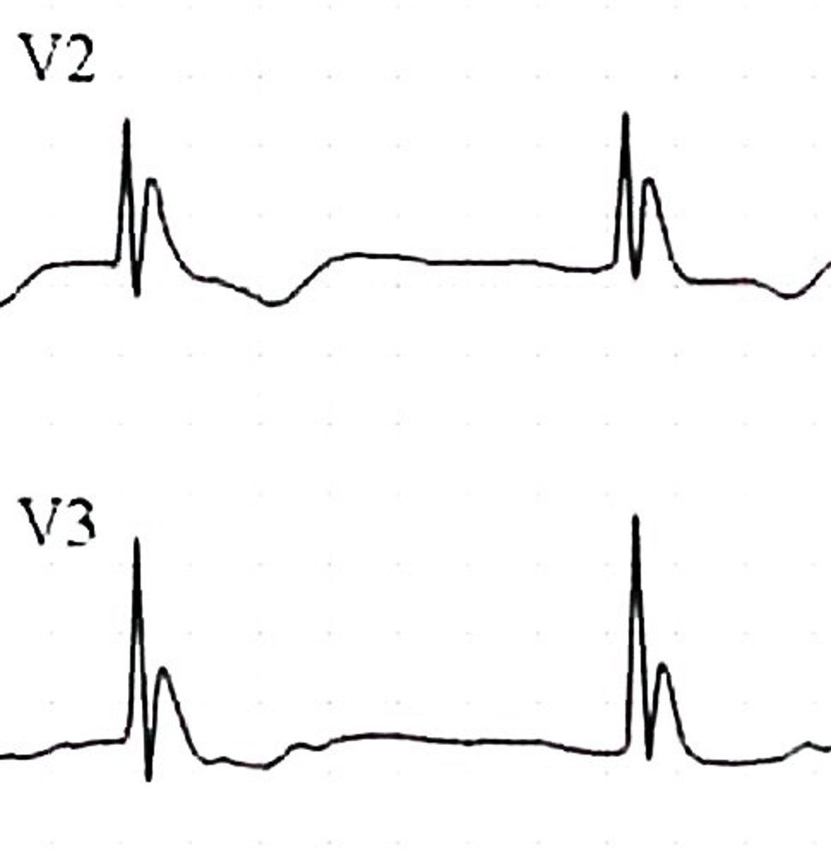 <p>Little hump after S</p>